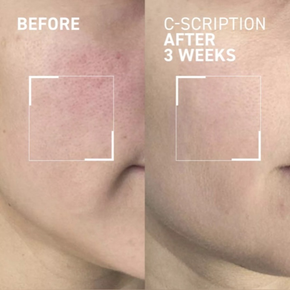 Dr Brandt C Scription Brightening Serum (B2) - Picture 4 of 7
